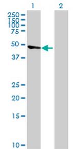 ECGF1 Antibody in Western Blot (WB)