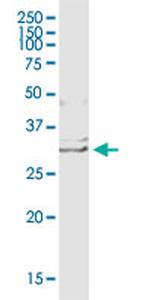 EDN1 Antibody in Western Blot (WB)