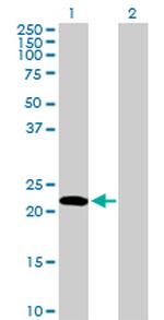 EDN1 Antibody in Western Blot (WB)