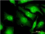 EIF2S3 Antibody in Immunocytochemistry (ICC/IF)