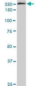 EIF4G1 Antibody in Western Blot (WB)