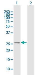 ELA1 Antibody in Western Blot (WB)