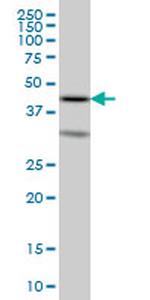 ELF3 Antibody in Western Blot (WB)