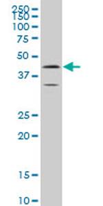 ELF3 Antibody in Western Blot (WB)