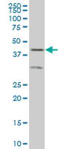 ELF3 Antibody in Western Blot (WB)