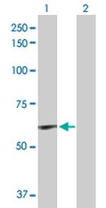 ELN Antibody in Western Blot (WB)