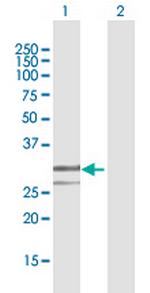 ENDOG Antibody in Western Blot (WB)