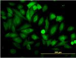 ENO1 Antibody in Immunocytochemistry (ICC/IF)