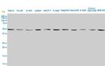 ENO2 Antibody in Western Blot (WB)