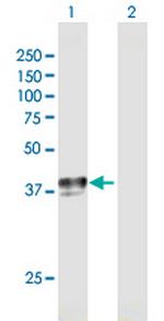 SLC29A1 Antibody in Western Blot (WB)