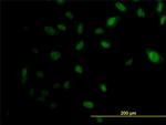 EP300 Antibody in Immunocytochemistry (ICC/IF)