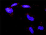 EPAS1 Antibody in Proximity Ligation Assay (PLA) (PLA)