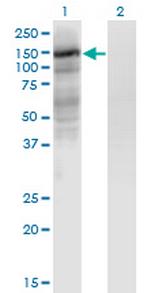 EPAS1 Antibody in Western Blot (WB)