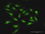 STOM Antibody in Immunocytochemistry (ICC/IF)