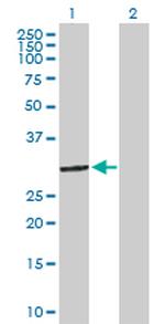 STOM Antibody in Western Blot (WB)