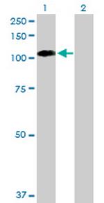 EPHB1 Antibody in Western Blot (WB)