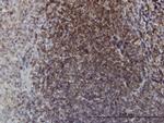 EPHB3 Antibody in Immunohistochemistry (Paraffin) (IHC (P))