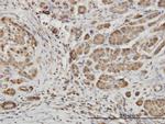 EPHB6 Antibody in Immunohistochemistry (Paraffin) (IHC (P))