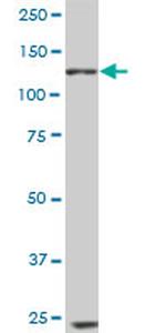 EPHB6 Antibody in Western Blot (WB)