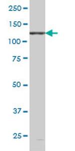 EPHB6 Antibody in Western Blot (WB)