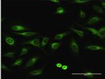 EPHX1 Antibody in Immunocytochemistry (ICC/IF)