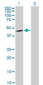 EPHX1 Antibody in Western Blot (WB)