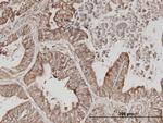 ERBB3 Antibody in Immunohistochemistry (Paraffin) (IHC (P))