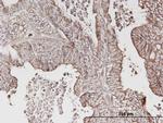 ERBB3 Antibody in Immunohistochemistry (Paraffin) (IHC (P))