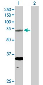 ERCC2 Antibody in Western Blot (WB)