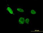 ERF Antibody in Immunocytochemistry (ICC/IF)