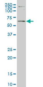 ERF Antibody in Western Blot (WB)