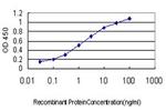 ERN1 Antibody in ELISA (ELISA)