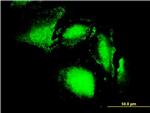 ERN1 Antibody in Immunocytochemistry (ICC/IF)