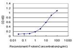 ERN1 Antibody in ELISA (ELISA)