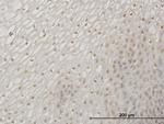 ERN1 Antibody in Immunohistochemistry (Paraffin) (IHC (P))