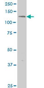 ERN1 Antibody in Western Blot (WB)