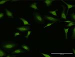 ESR1 Antibody in Immunocytochemistry (ICC/IF)