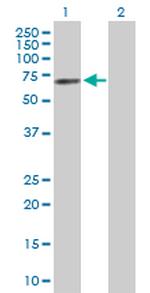 ESR1 Antibody in Western Blot (WB)