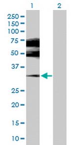 ESR2 Antibody in Western Blot (WB)