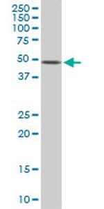 ETV5 Antibody in Western Blot (WB)