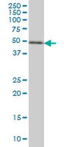 ETV5 Antibody in Western Blot (WB)