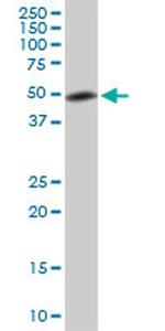 ETV5 Antibody in Western Blot (WB)