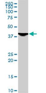 EVX1 Antibody in Western Blot (WB)