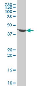 EVX1 Antibody in Western Blot (WB)