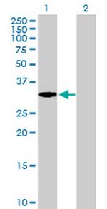 EXTL2 Antibody in Western Blot (WB)