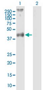 F2R Antibody in Western Blot (WB)