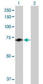 F11 Antibody in Western Blot (WB)