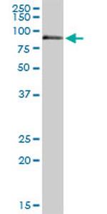 F11 Antibody in Western Blot (WB)