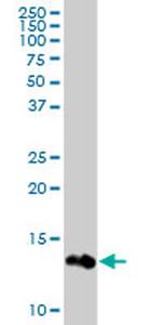 FABP1 Antibody in Western Blot (WB)