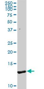 FABP1 Antibody in Western Blot (WB)